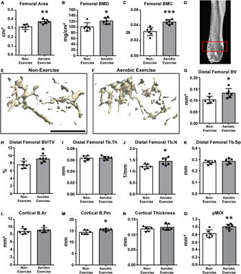 Trabecular Bone Microarchitecture Improvement Is Associated With Skeletal Nerve Increase Following Aerobic Exercise Training in Middle-Aged Mice